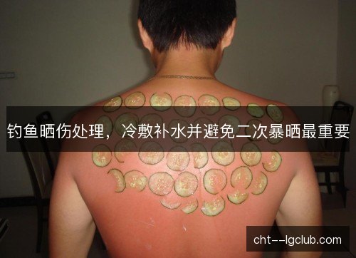 钓鱼晒伤处理，冷敷补水并避免二次暴晒最重要